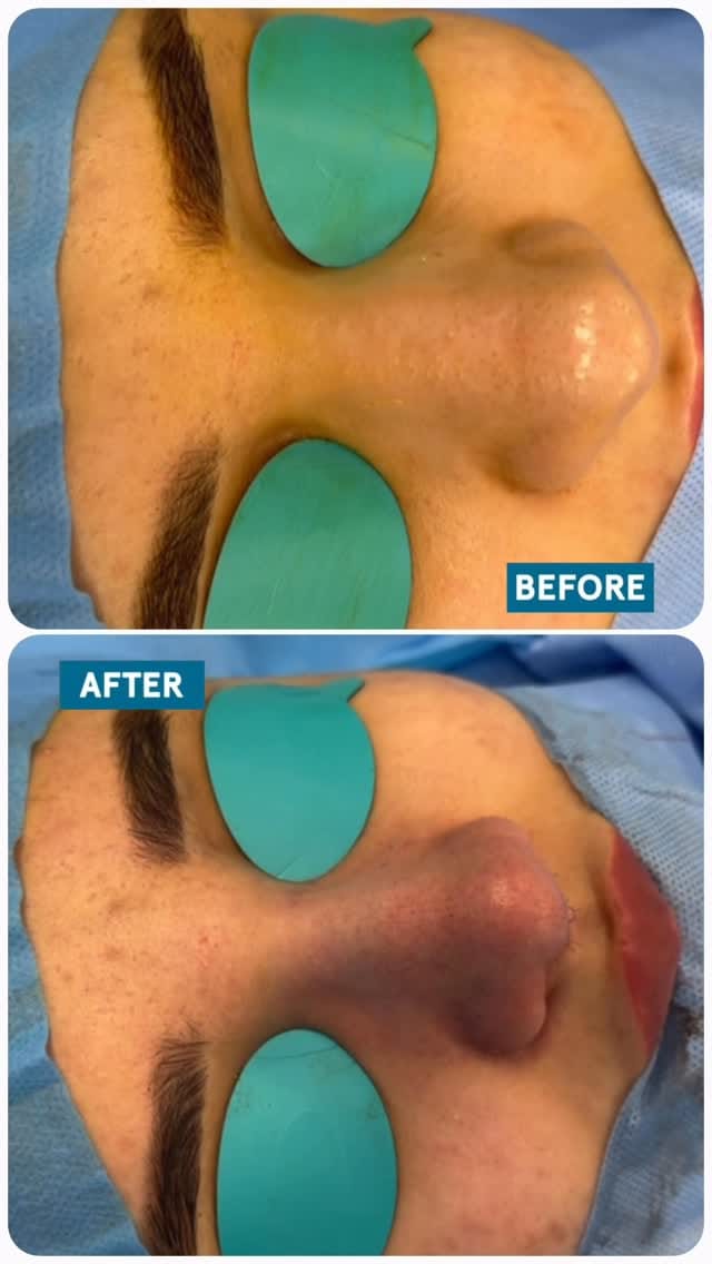 Post 4 by Plastic Surgeon Dubai on Instagram (video)