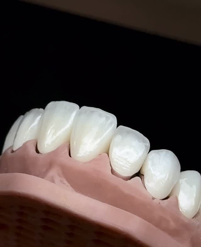 Post 5 by 𝑫𝑹.𝑨𝑵𝑻𝑰𝑨 on Instagram (video)