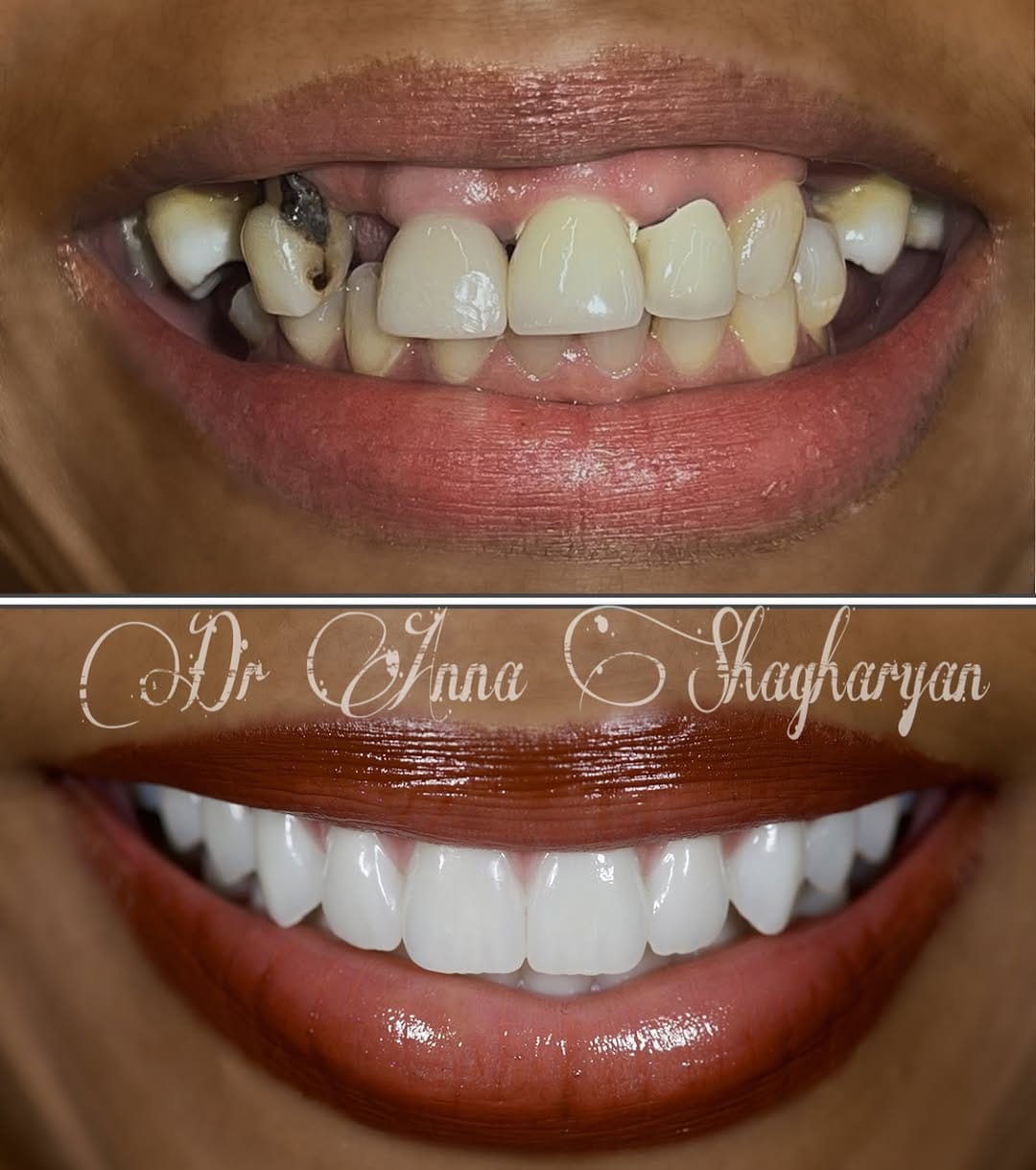 Post 9 by AVIVA Dental Implant Center on Instagram (image)