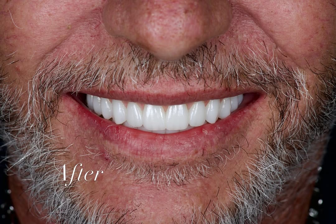 Post 3 by AVIVA Dental Implant Center on Instagram (carousel)
