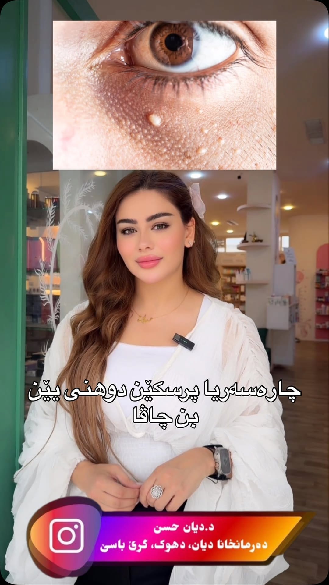 Post 8 by Dr.diyan hassan on Instagram (video)