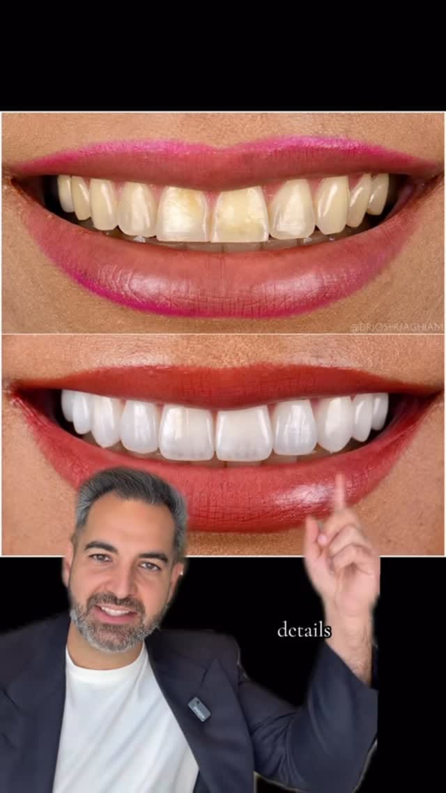 Post 4 by Dr. Joshua Ghiam on Instagram (video)