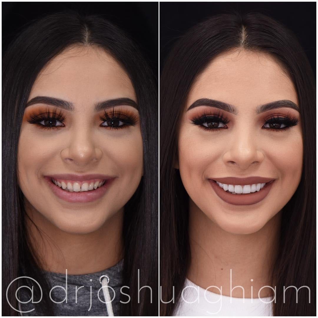 Post 10 by Dr. Joshua Ghiam on Instagram (image)