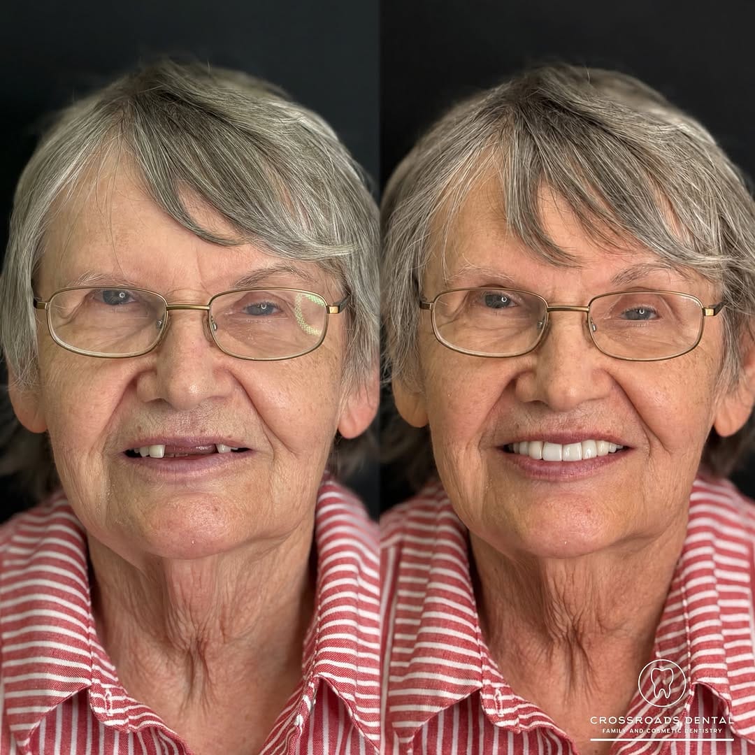 Post 1 by Crossroads Dental Family and Cosmetic Dentistry on Instagram (image)