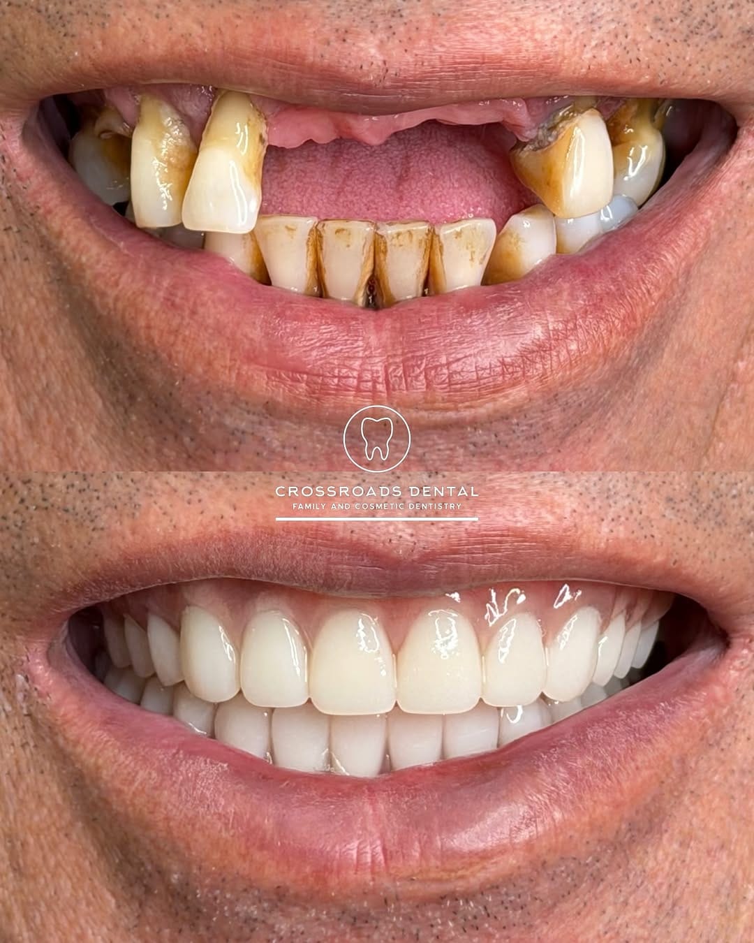 Post 6 by Crossroads Dental Family and Cosmetic Dentistry on Instagram (image)