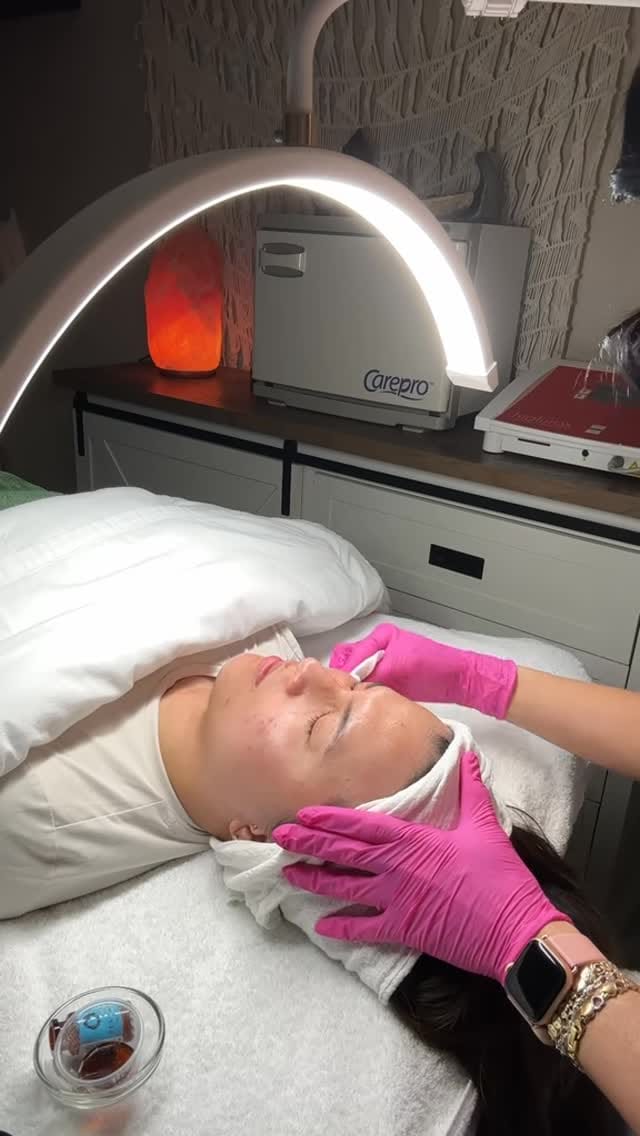 Post 4 by Sonia Cona | Acne Specialist Brampton on Instagram (video)