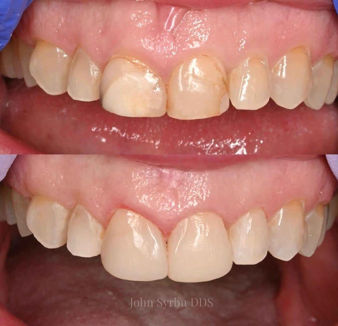 Post 4 by John Syrbu DDS on Instagram (image)