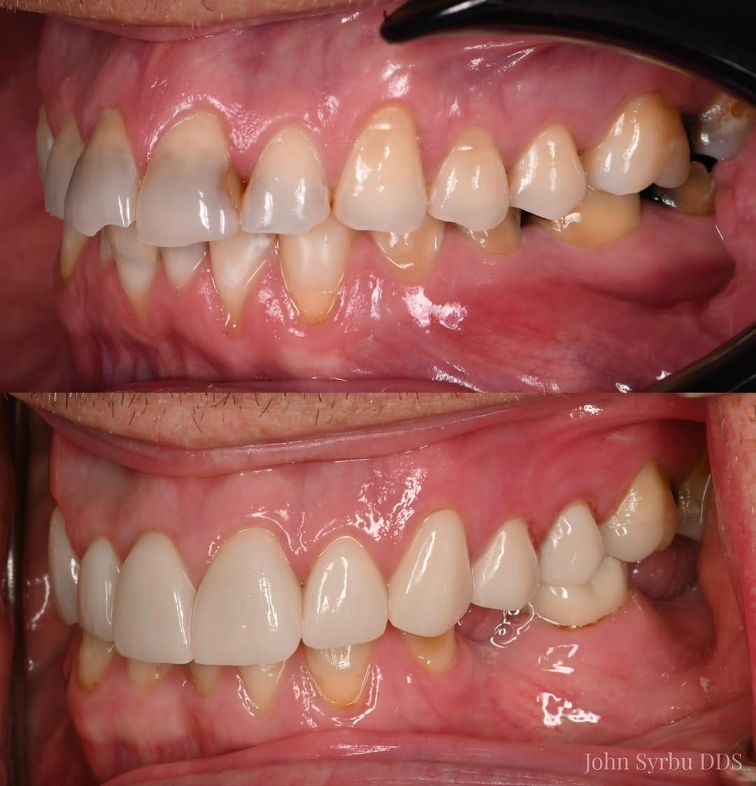 Post 1 by John Syrbu DDS on Instagram (image)