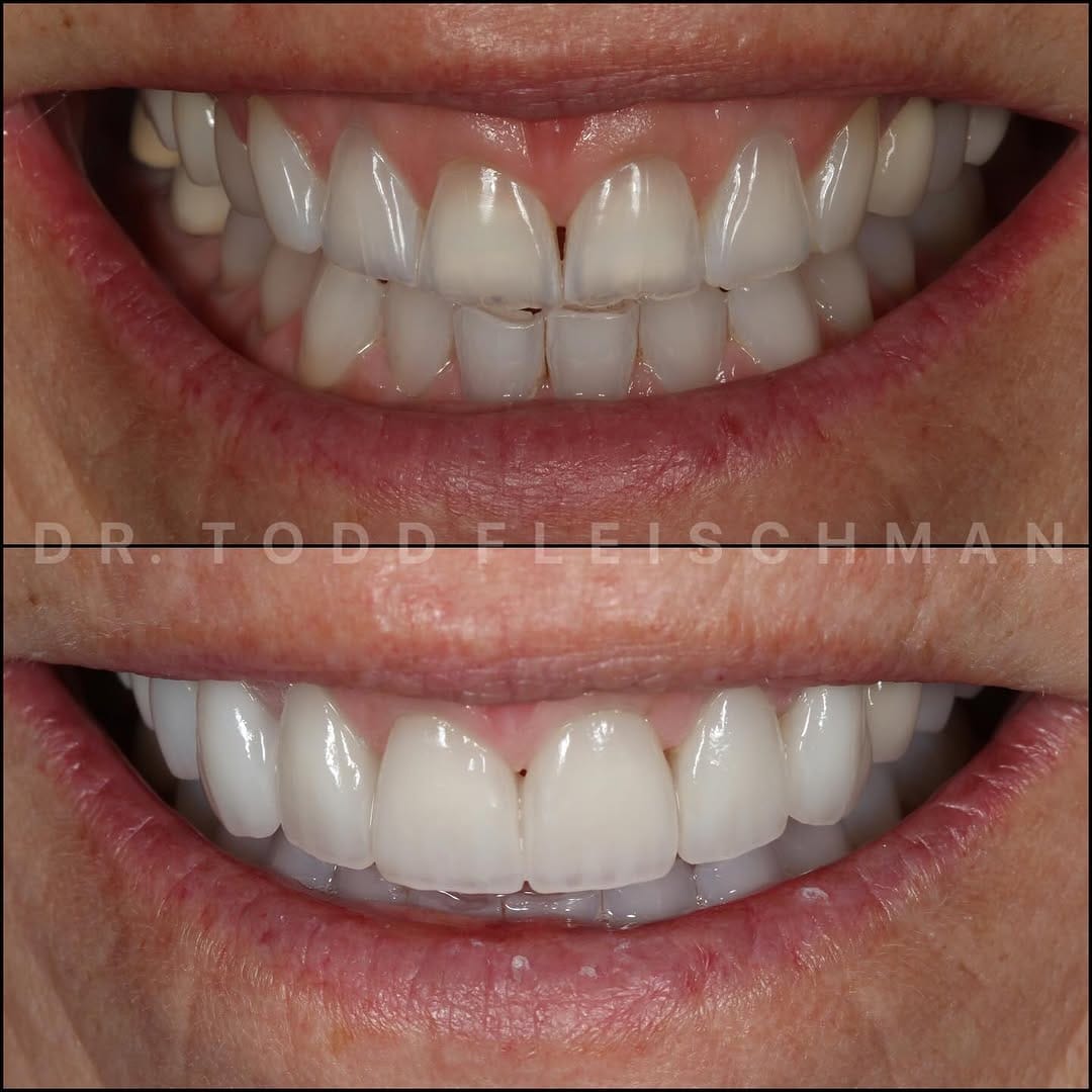 Post 6 by Dr. Todd A. Fleischman & Associates on Instagram (carousel)