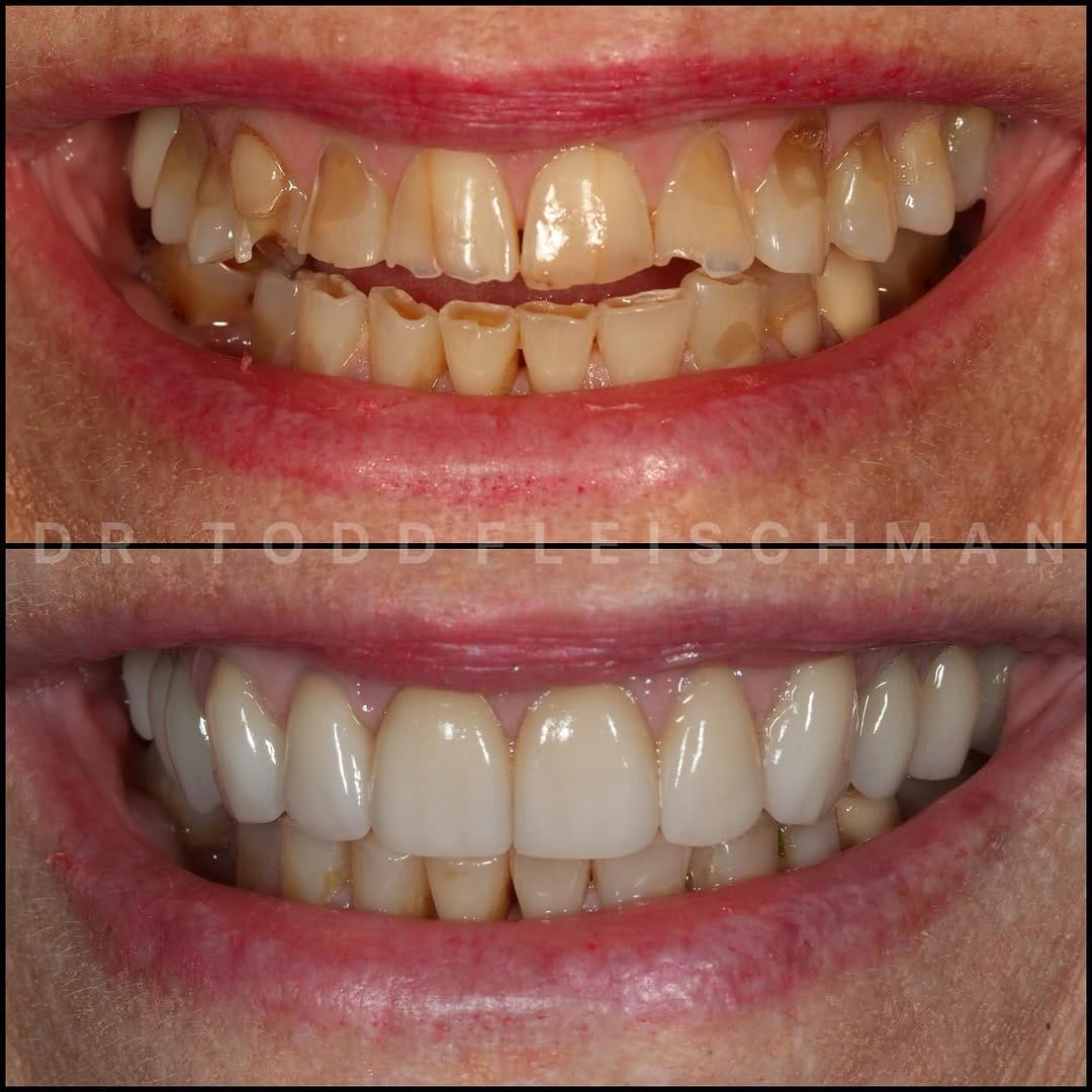 Post 8 by Dr. Todd A. Fleischman & Associates on Instagram (carousel)