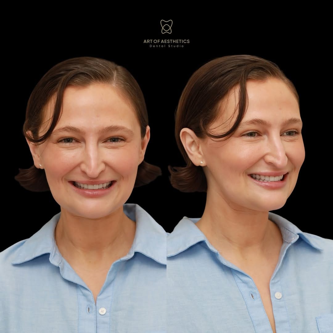 Post 2 by Art of Aesthetics Dental Studio on Instagram (carousel)