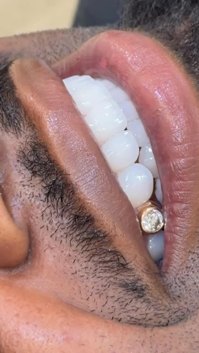 Post 4 by Art of Aesthetics Dental Studio on Instagram (video)