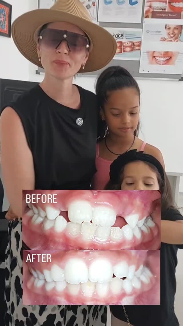 Post 6 by Dr. Dina's Dental Clinic on Instagram (video)