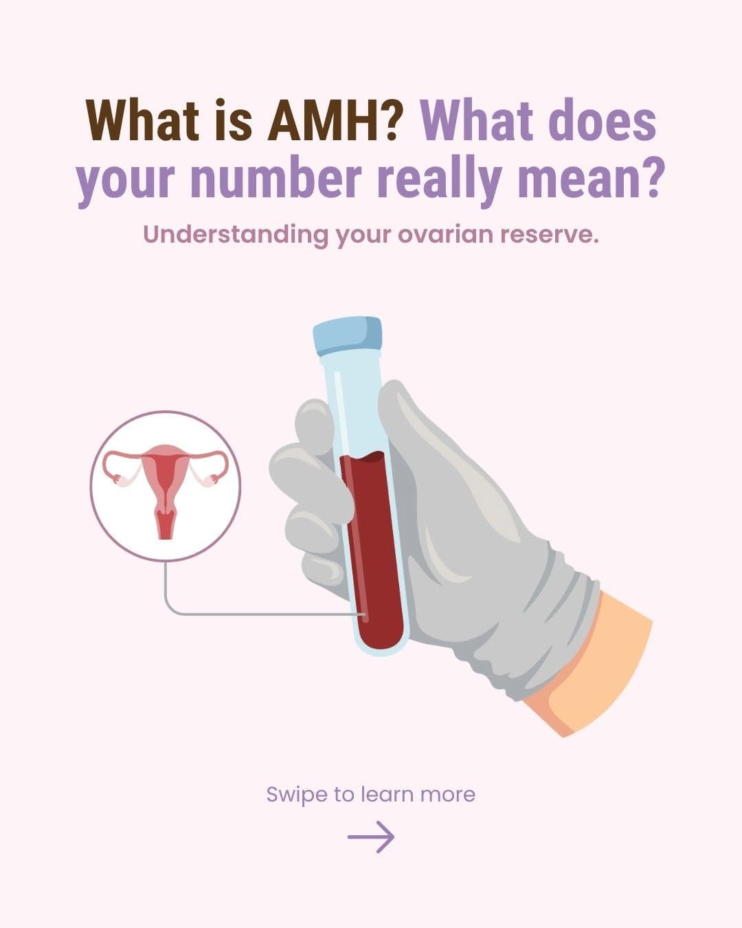 Post 5 by Reproductive Fertility Center on Instagram (carousel)