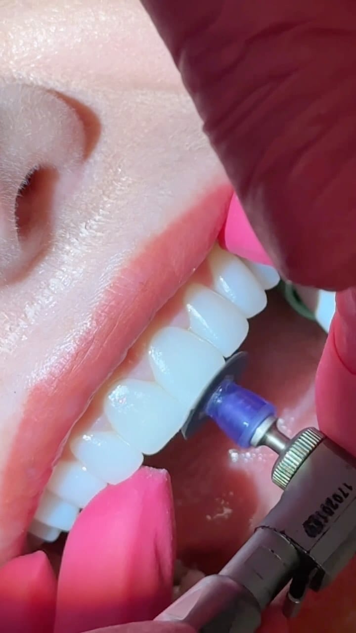 Post 10 by Tori Dixon DMD on Instagram (video)