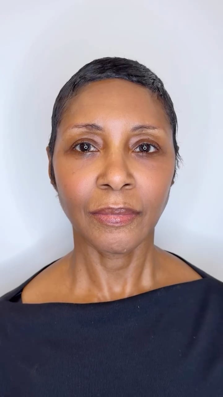 Post 8 by Muma Aesthetics | DMV Facial Balancing, Botox, Filler & More on Instagram (video)