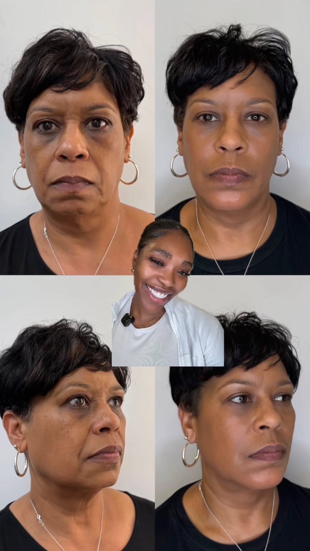 Post 4 by Muma Aesthetics | DMV Facial Balancing, Botox, Filler & More on Instagram (video)