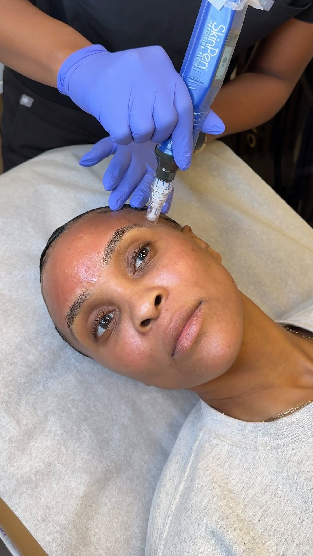 Post 7 by Muma Aesthetics | DMV Facial Balancing, Botox, Filler & More on Instagram (video)