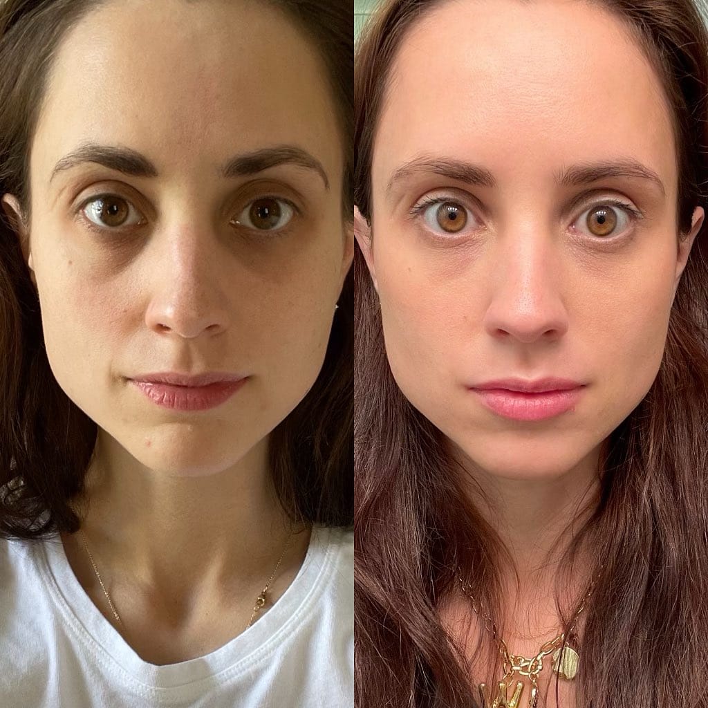Post 9 by Monica Bravo, MD FAAD on Instagram (image)