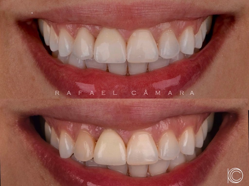Post 9 by Rafael Câmara on Instagram (image)