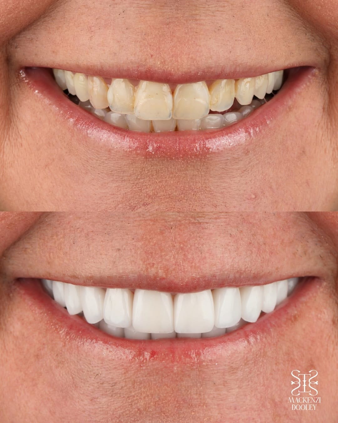 Post 6 by Mackenzi Dooley DDS on Instagram (carousel)