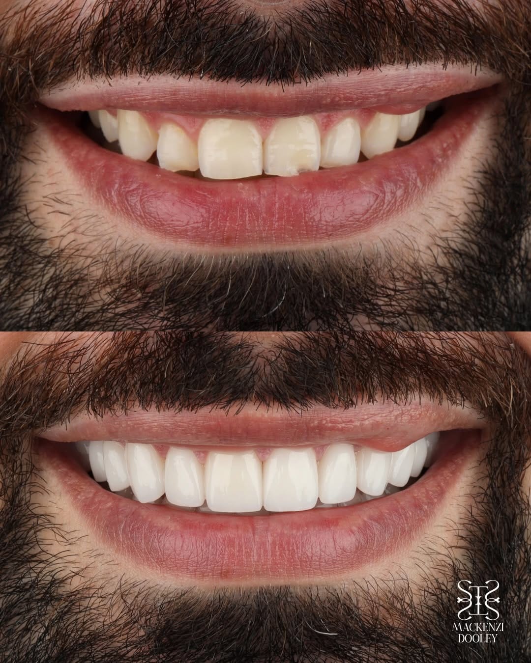 Post 1 by Mackenzi Dooley DDS on Instagram (carousel)
