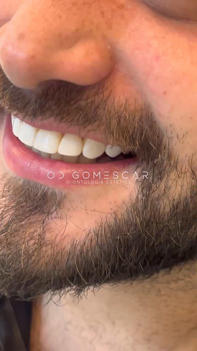 Post 1 by 𝗗𝗥. 𝗔𝗚𝗨𝗦𝗧Í𝗡 𝗚𝗢𝗠𝗘𝗦 𝗖𝗔𝗥                      “ᴇɴ ʙᴏᴄᴀ ᴅᴇ ᴛᴏᴅᴏs” on Instagram (video)