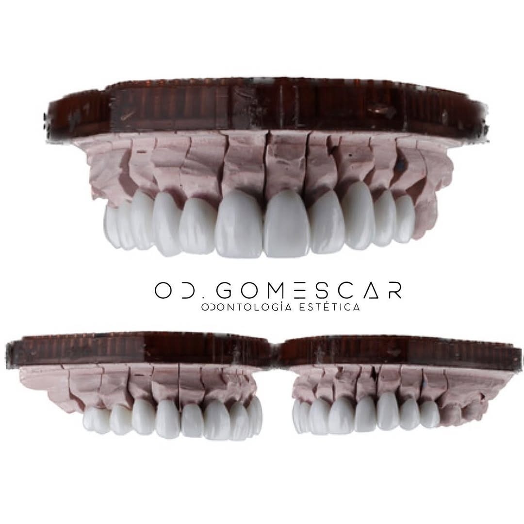Post 9 by 𝗗𝗥. 𝗔𝗚𝗨𝗦𝗧Í𝗡 𝗚𝗢𝗠𝗘𝗦 𝗖𝗔𝗥                      “ᴇɴ ʙᴏᴄᴀ ᴅᴇ ᴛᴏᴅᴏs” on Instagram (carousel)