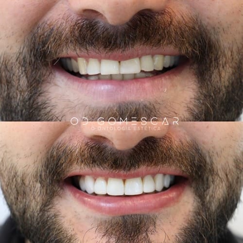 Post 7 by 𝗗𝗥. 𝗔𝗚𝗨𝗦𝗧Í𝗡 𝗚𝗢𝗠𝗘𝗦 𝗖𝗔𝗥                      “ᴇɴ ʙᴏᴄᴀ ᴅᴇ ᴛᴏᴅᴏs” on Instagram (carousel)