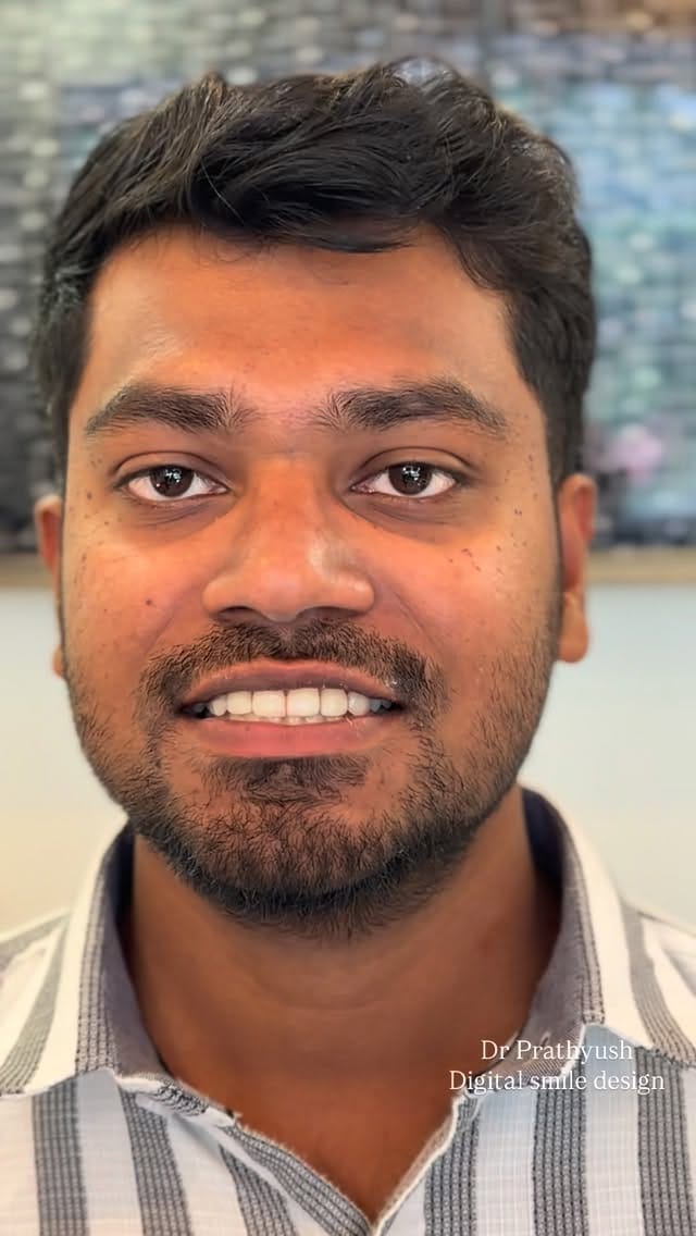 Post 8 by DrPrathyush P Pillai on Instagram (video)