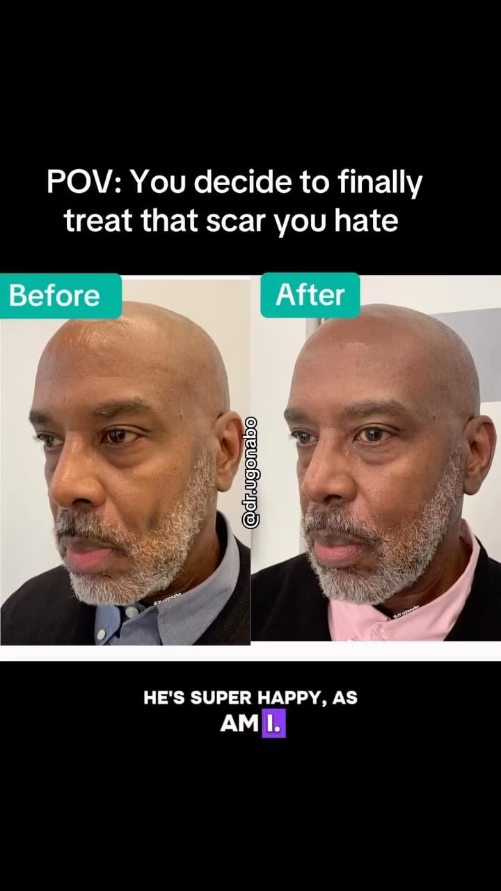 Post 3 by Dr. Nkem Ugonabo MD, MPH - Dermatologist on Instagram (video)