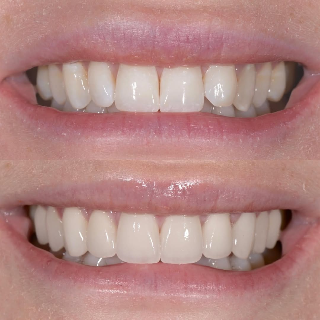 Post 1 by Nashville Aesthetic Dentistry on Instagram (carousel)
