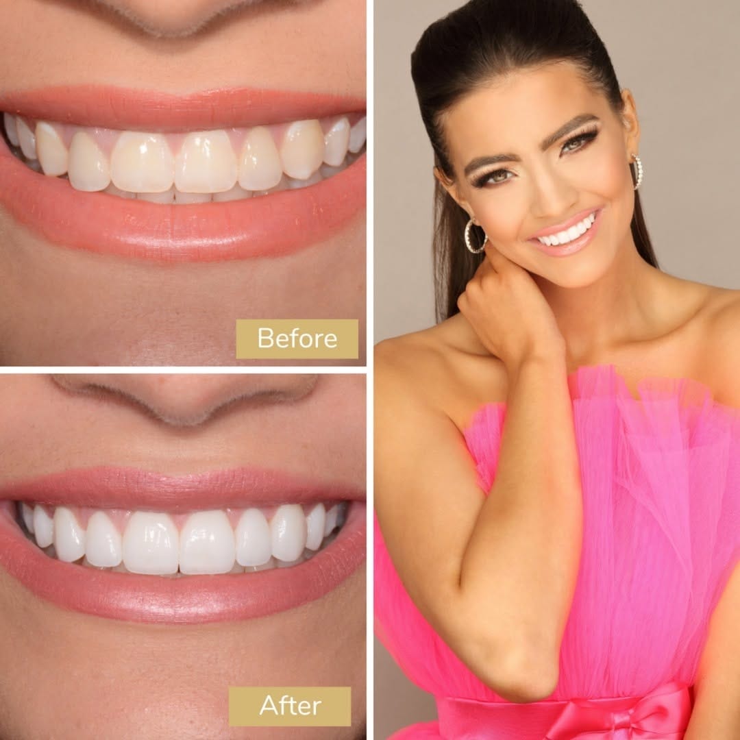 Post 10 by Nashville Aesthetic Dentistry on Instagram (image)