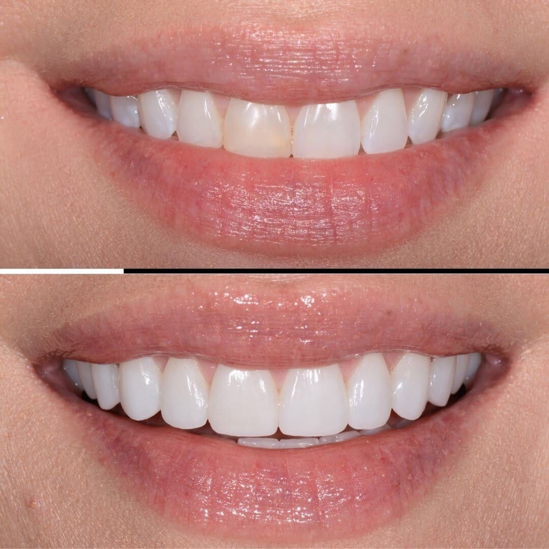 Post 9 by Nashville Aesthetic Dentistry on Instagram (image)