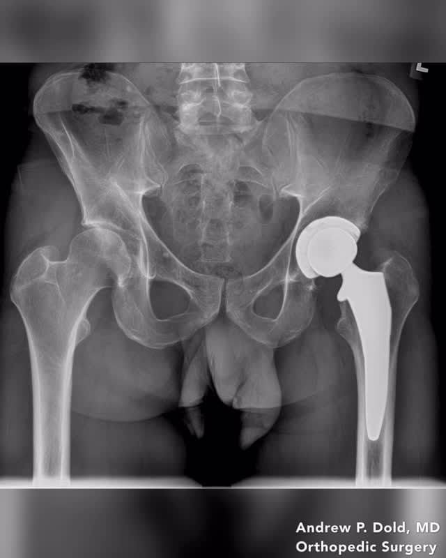 Post 6 by Dr. Andrew Dold • MD | Surgeon on Instagram (video)