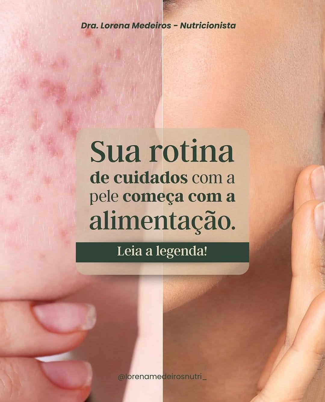 Post 7 by Lorena Medeiros CRN 46308 | Nutrição e Genética on Instagram (image)