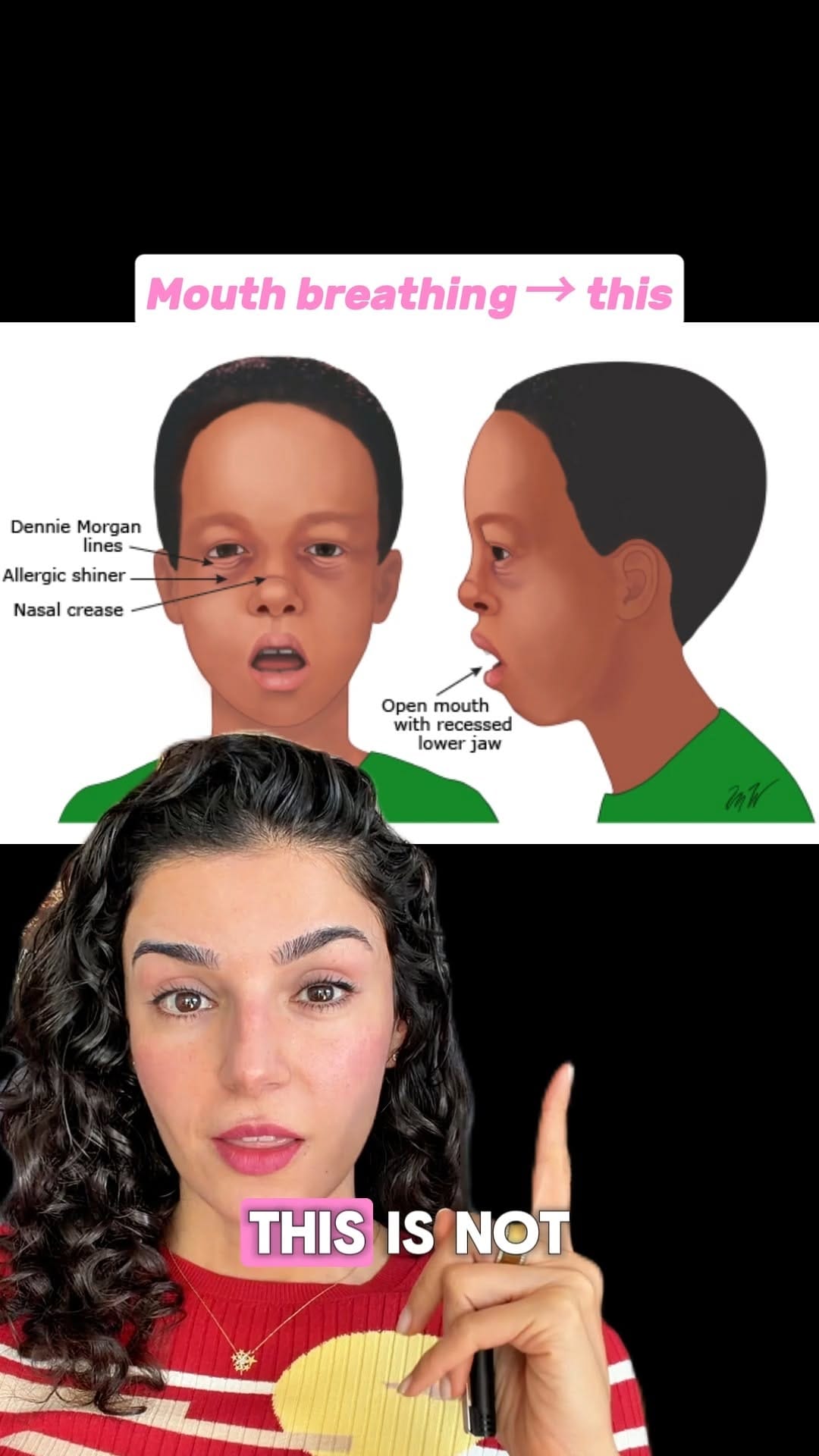 Post 7 by Nilay Donmez, MD | NYC Pediatrician on Instagram (video)