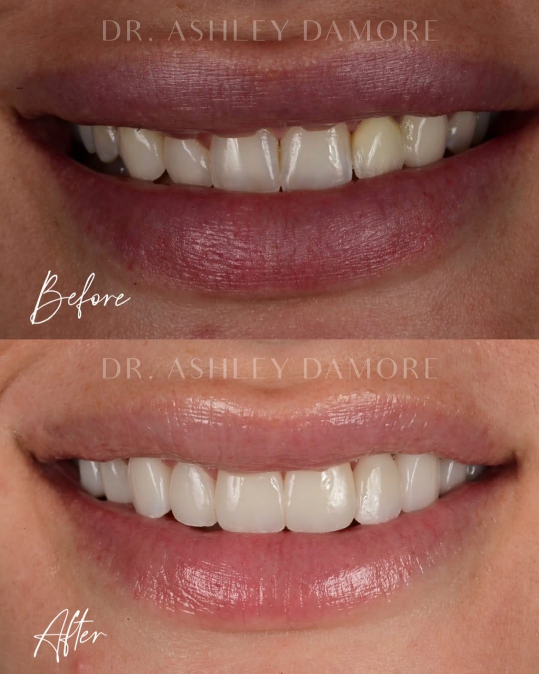 Post 4 by Dr. Ashley Rose Damore on Instagram (carousel)