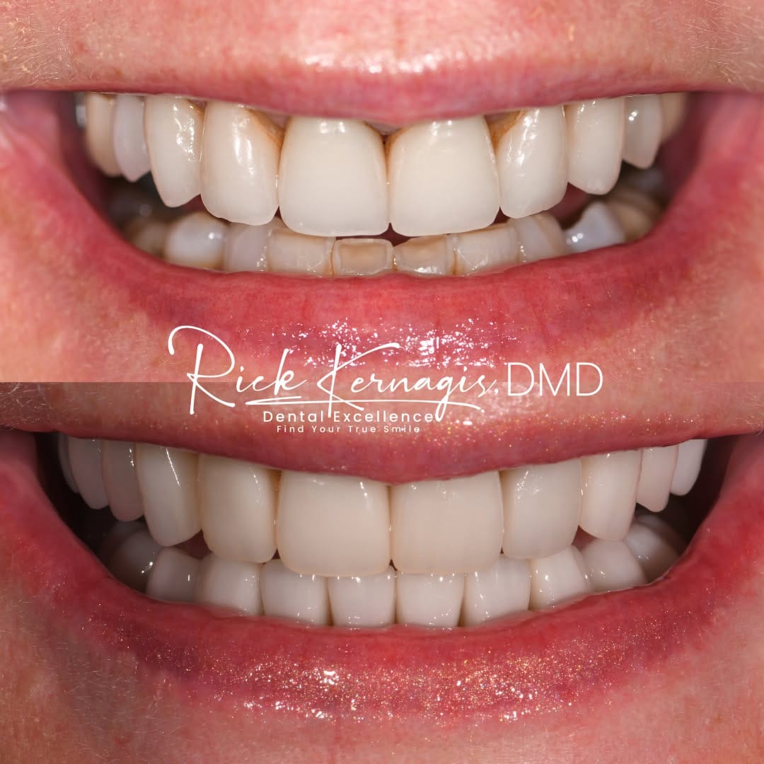 Post 2 by Rick Kernagis DMD on Instagram (image)