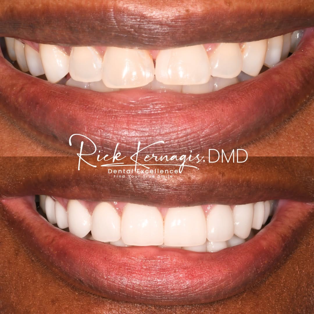 Post 6 by Rick Kernagis DMD on Instagram (image)