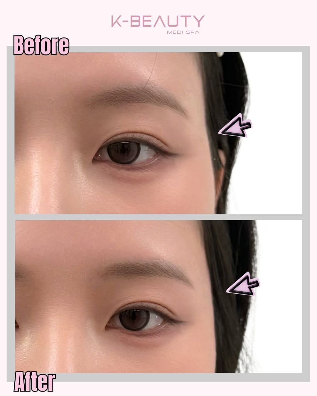 Post 6 by K-Beauty Medi Spa on Instagram (carousel)