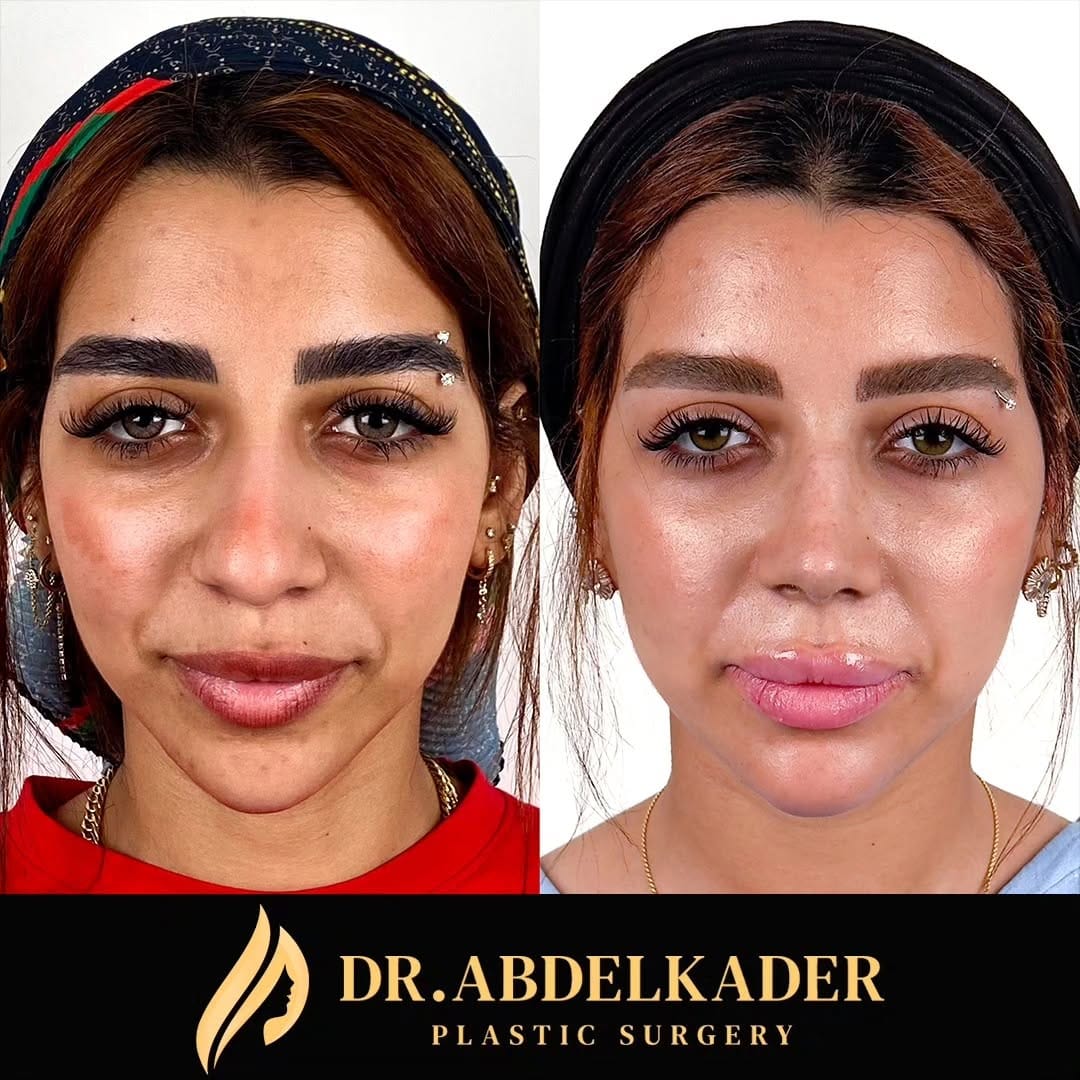 Post 1 by Dr. Mohamed Abdelkader on Instagram (carousel)