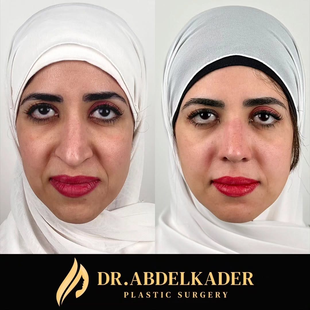 Post 4 by Dr. Mohamed Abdelkader on Instagram (carousel)