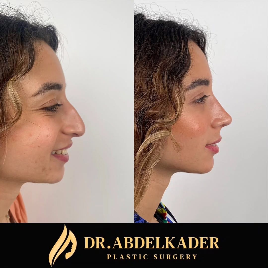 Post 7 by Dr. Mohamed Abdelkader on Instagram (carousel)