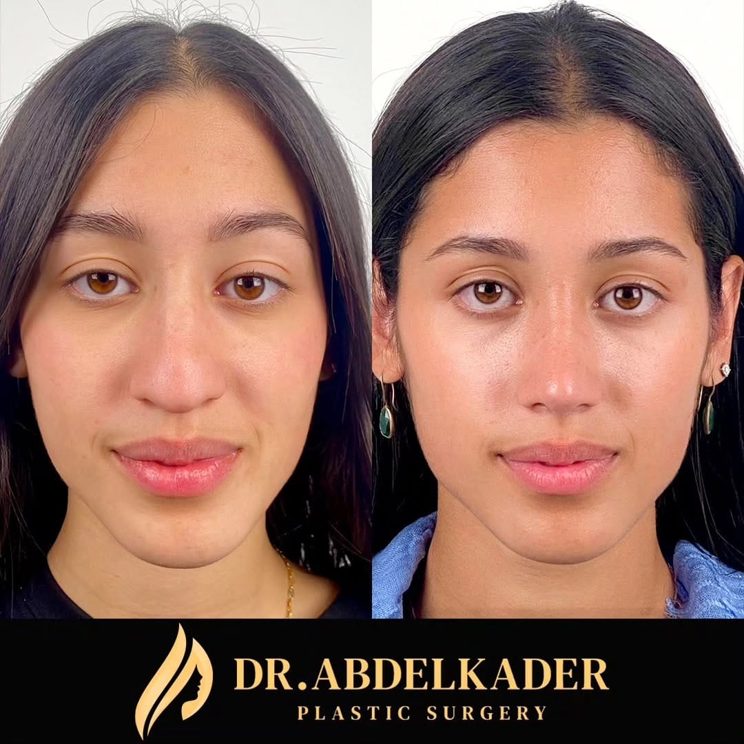 Post 6 by Dr. Mohamed Abdelkader on Instagram (carousel)