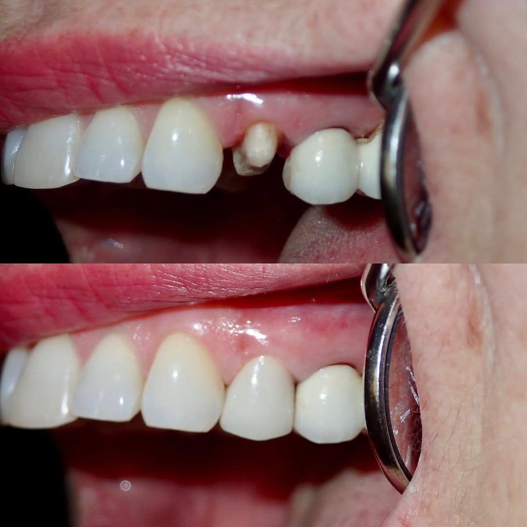 Post 4 by MONICA KIM | Dentist on Instagram (image)