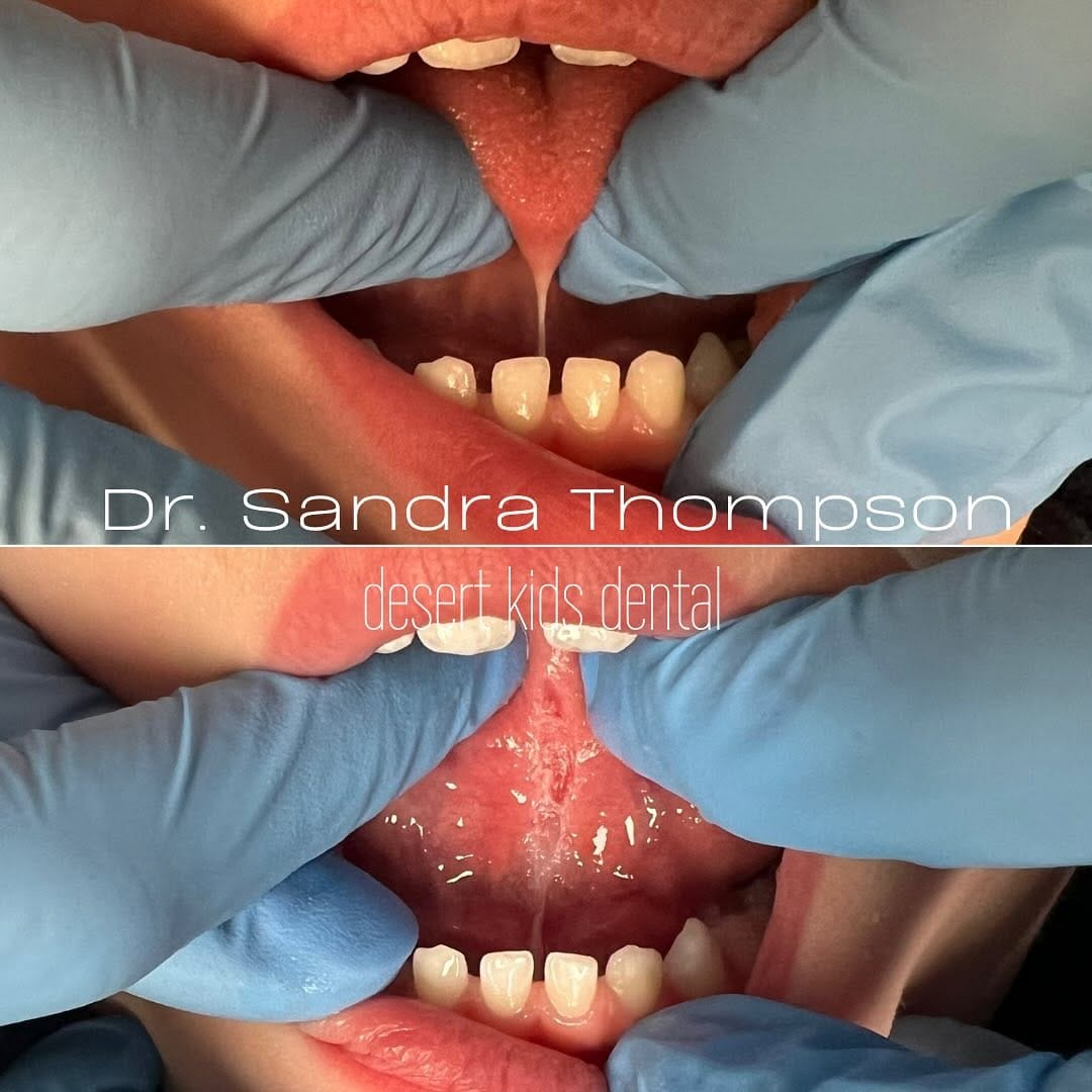 Post 7 by Desert Kids Dental on Instagram (image)