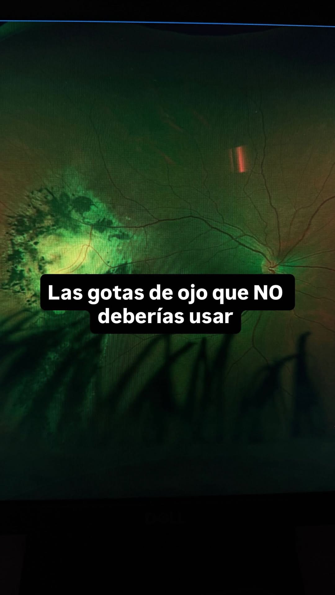 Post 6 by Jose Garcia | Eye Doctor on Instagram (video)