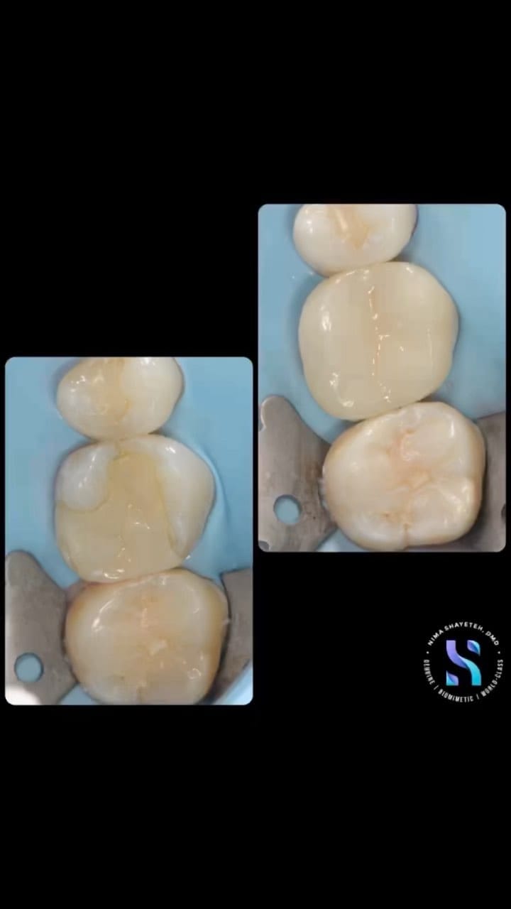 Post 10 by Nima Shayesteh on Instagram (video)
