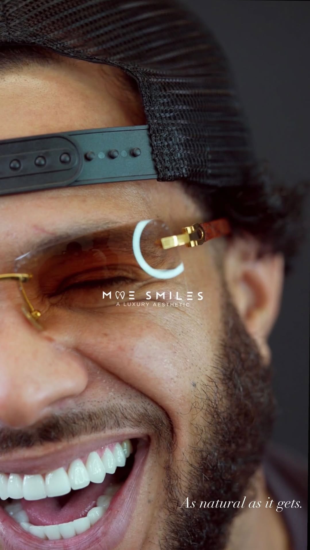 Post 5 by Dr. Mohamed Hassan | Houston Cosmetic Dentist | Veneers Expert on Instagram (video)